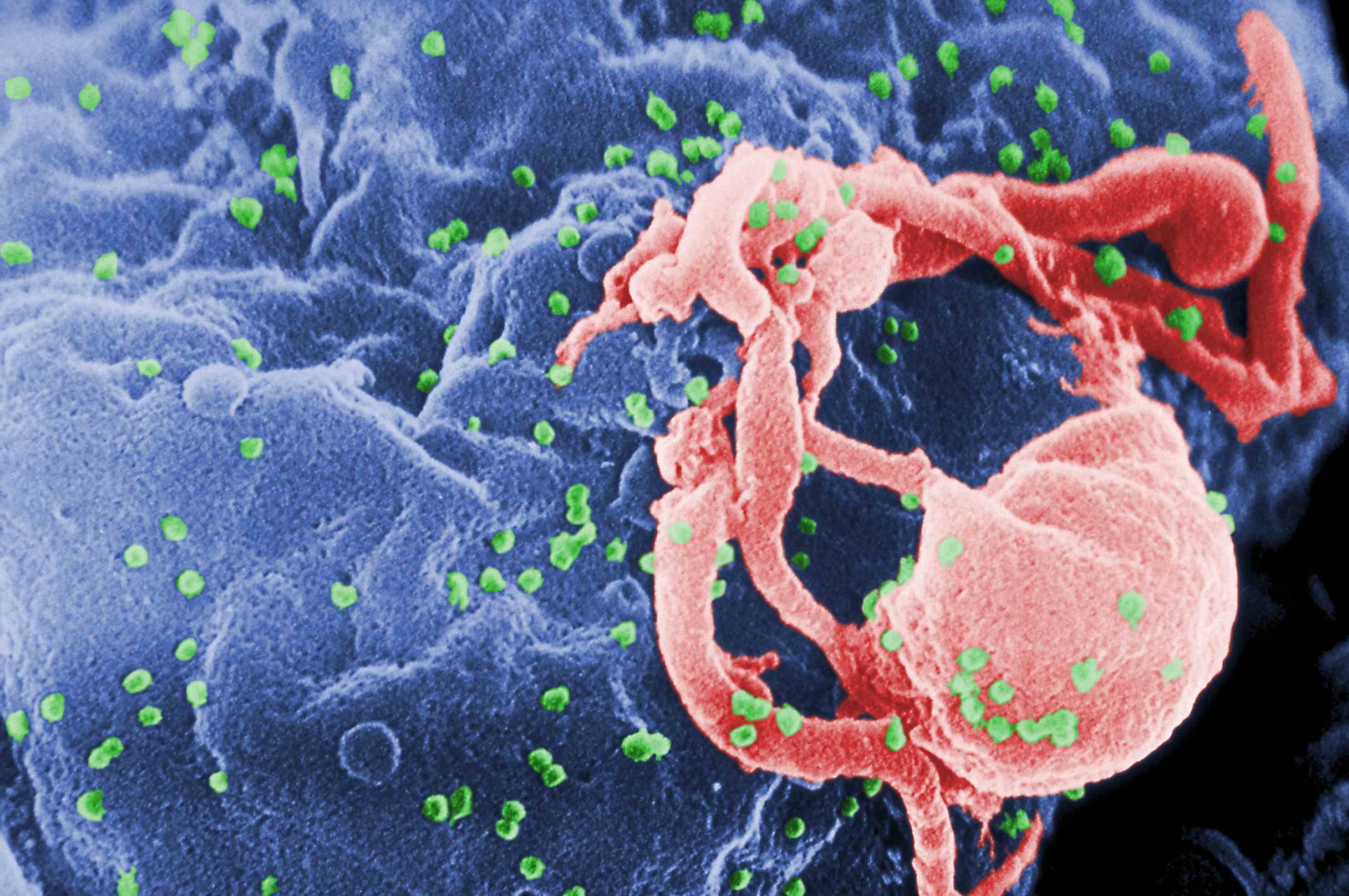 38 Feiten Over HIV