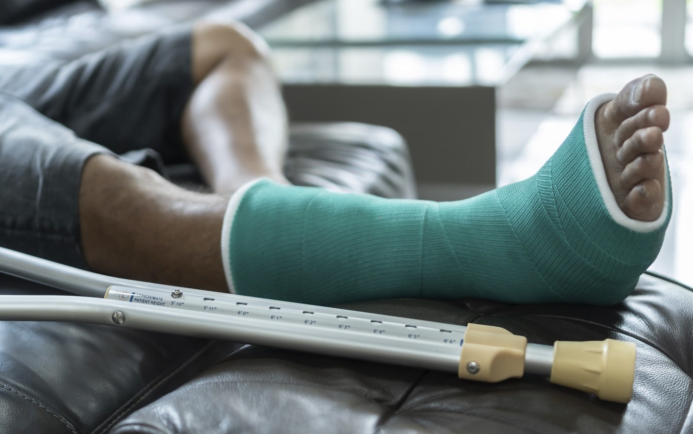 39 Feiten Over Fractuur